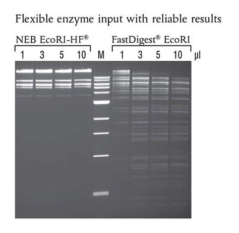 HF Enzyme New England Biolabs GmbH