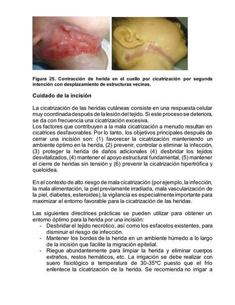 INCISIONES QUIRURGICAS EN CARA Y CUELLO PDF