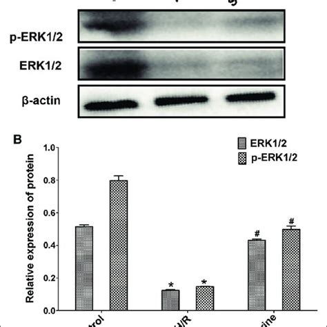 Protein Expression Levels Of Erk And P Erk In Three Groups Of