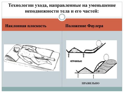 Пролежни. Организация ухода - online presentation