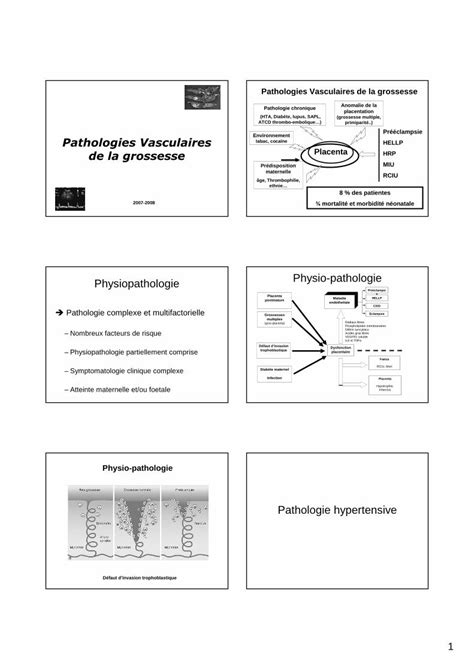 Pdf Pathologie Chronique Atcd Thrombo Embolique Alcciago Free Fr