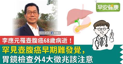 李應元罹壺腹癌68歲病逝！罕見壺腹癌早期難發覺，胃鏡檢查外4大徵兆該注意 文章分享