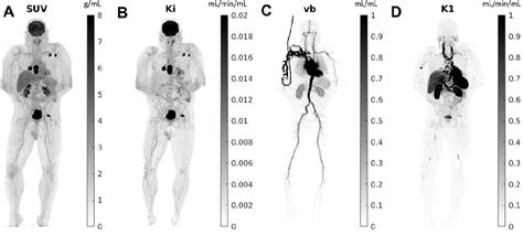 Figure From Advantages And Applications Of Total Body Pet Scanning