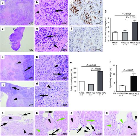 Ngal Overexpression Enhanced Tumorigenesis And Potentially Increased Download Scientific