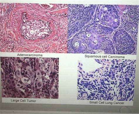 Solved If You Observed Pathological Lung Sections Record Chegg