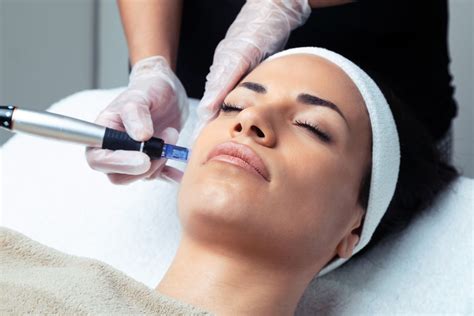 Facial Microneedling Near Me Microneedling Services Midland