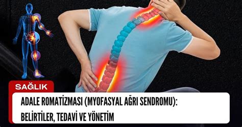 Adale Romatizması Myofasyal Ağrı Sendromu Belirtiler Tedavi ve