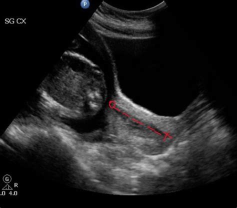 Ob Midterm Maternal Anatomy Flashcards Quizlet