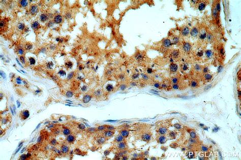 MYO16 antibody 18828 1 AP Proteintech 武汉三鹰生物技术有限公司