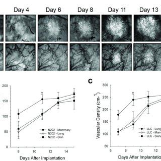 A D N202 A And B And LLC C And D Tumor Spheroids Expressing