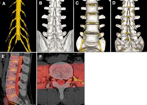 Three Dimensional 3D Computed Tomography CT Magnetic Resonance