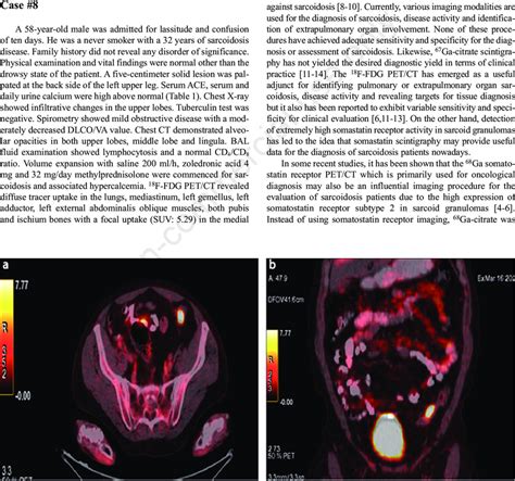 Axial A And Coronal B F Fdg Pet Ct Fusion Image Revealing A High