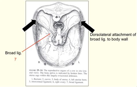 Female Reproductive Anatomy (Slides) Flashcards | Quizlet