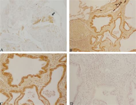 Representative Findings Of Mnsod And Cuznsod Immunoreactivity In