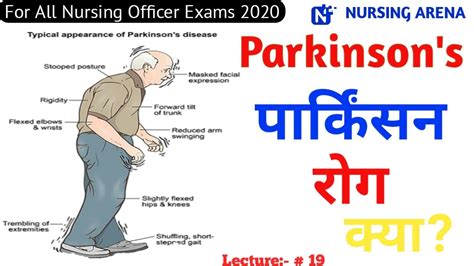 Parkinson Disease In Hindi Shaking Palsy Parkinsons Disease