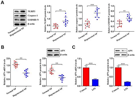 Figure From Adiponectin Inhibits Lps Induced Nucleus Pulposus Cell