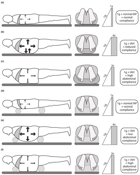 Integrated Theory Of Abdominal Pressure And Morphology In Relation To