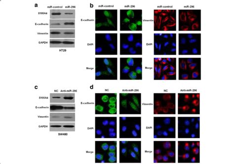 Mir Inhibits The Epithelial Mesenchymal Transition Of Crc Cells A