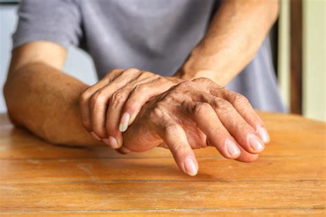 El S Ndrome De La Mano Ajena La Mente Es Maravillosa