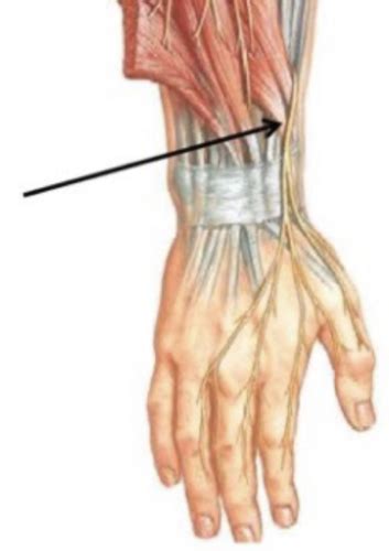 PT Management Of Wrist And Hand Pathologies Part 2 Flashcards Quizlet