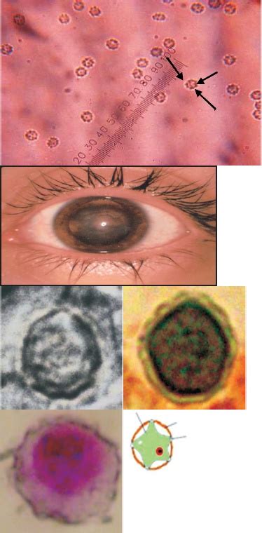 Microbiologia Y Parasitologia 2e Unpa Acanthamoeba Castellani