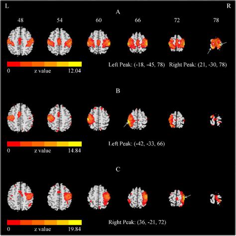 The representative SMN with the total number of components = 40. (A)... | Download Scientific ...