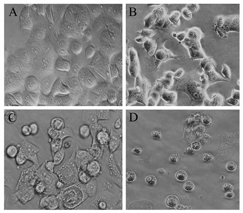 Radiosensitizing Effects Of Arsenic Trioxide On MCF 7 Human Breast