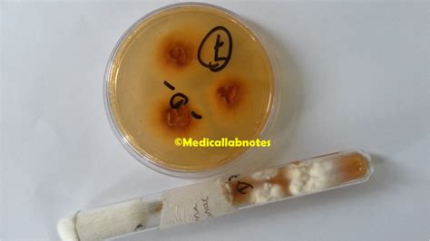 Trichophyton Mentagrophytes Introduction Morphology Pathogen