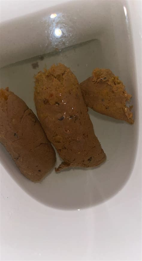 Do them black bits on my poop look concerning and is it blood? : r/poop