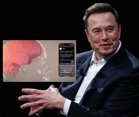 As Funciona El Primer Chip Cerebral De Elon Musk Que Controla