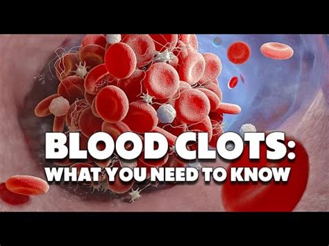 11 Warning Signs Of Blood Clotting That You Must Not Ignore YouTube