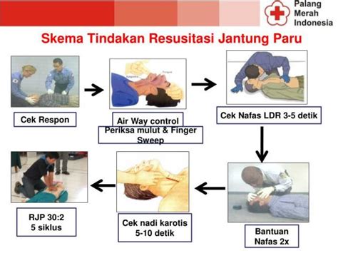 Teknik Dasar Resusitasi Jantung Paru Menyelamatkan Nyawa Dengan