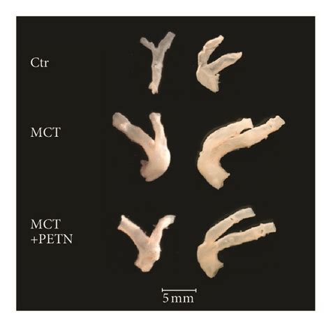 Effects Of Petn Therapy On Heart Body And Lung Body Weight Ratio