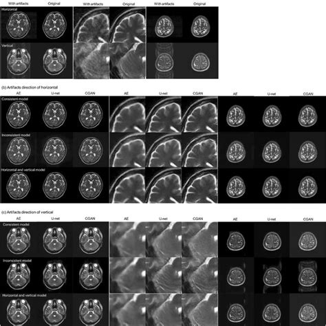 Results Of Motion Corrected Images By The Autoencoder Ae U Net And