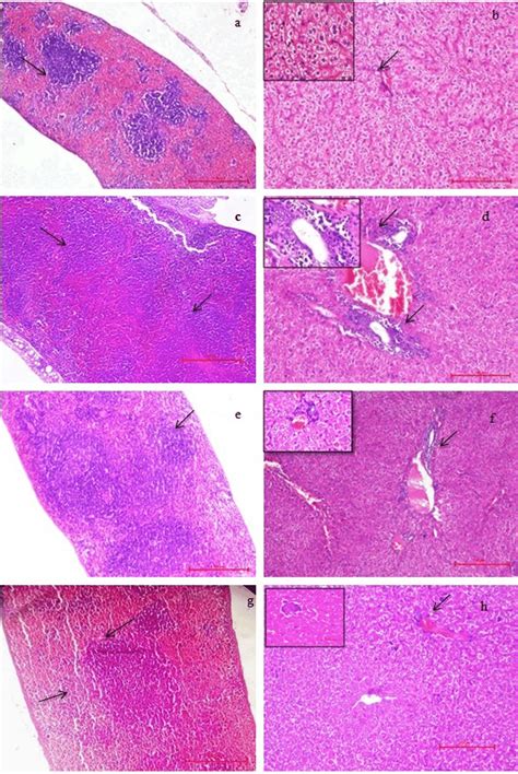 Histopathology Of The Spleen 40x And Liver 100x A Spleen Of