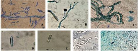 Morfologia De Con Dios Pertencentes Aos G Neros F Ngicos Fusarium Sp