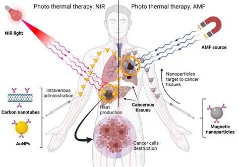 Target Nanoparticles Against Pancreatic Cancer Fewer Side Effects In Therapy V1