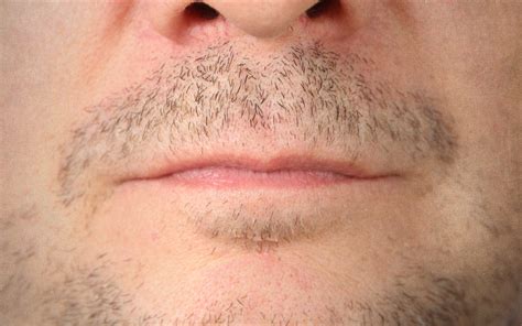 How To Fix Patchy Beard 7 Ways To Improve Uneven Beard Growth The Beard Club