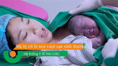 Mẹ bị vỡ ối non vượt cạn sinh thường như thế nào YouTube