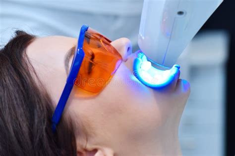 Laser Bleaching Teeth In Clinic Stock Photo Image Of Caucasian