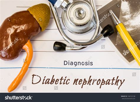 Diagnosis Diabetic Nephropathy Photo Figure Kidney Stock Photo