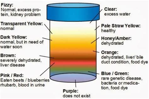 What Does The Color Of Your Urine Say About Your Health