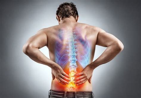 Understanding And Alleviating Back Pain A Comprehensive Guide