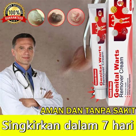 Ubat buang kutil ketuat tahi lalat biji kolestrol Genital Wart Herpes Remover Ointment Skin Tags ...