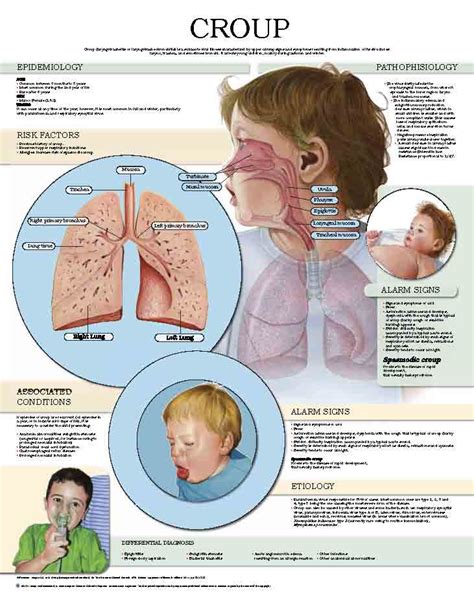 Croup Anejo