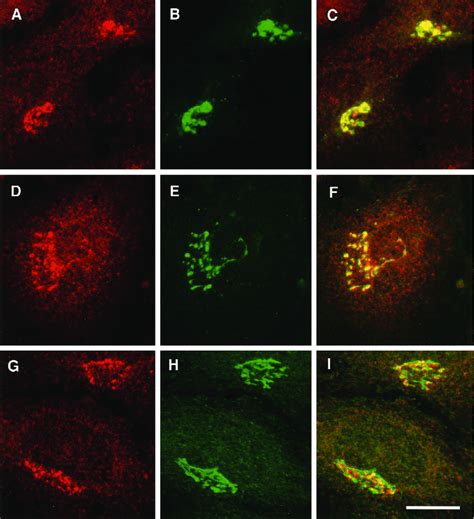 Double Immunofluorescence Staining Of Ap And Golgi Markers Hela