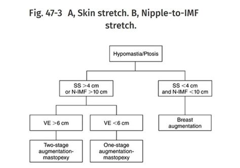 aug pexy flashcards quizlet