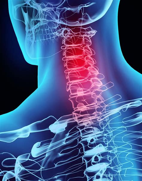 Facts About Whiplash Injuries Causes Symptoms Treatments