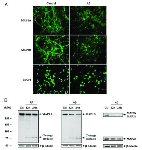 Time Dependent Degradation Of Microtubule Associated Proteins Map1a And