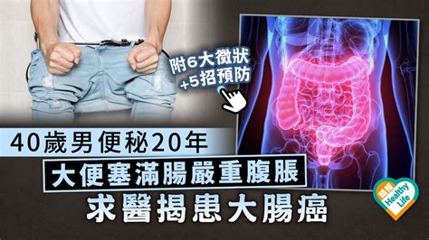 致命癌症︳40歲男便秘20年 大便塞滿腸嚴重腹脹 求醫揭患大腸癌︳附6大徵狀5招預防 晴報 健康 腫瘤及癌症 D230203